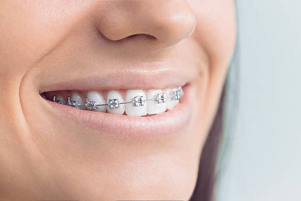 Laser Dentistry in Shorewood Tower Hills Harbert, MI